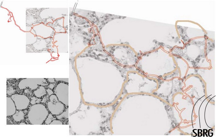 Sovrapposizione dell'immagine degli alveoli polmonari rispetto alla struttura dei tunnel. Struttura alveolare tipica del tunnel Ravne. (SBRG)